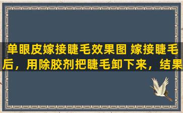 单眼皮嫁接睫毛效果图 嫁接睫毛后，用除胶剂把睫毛卸下来，结果不小心弄到眼睛里，怎么办